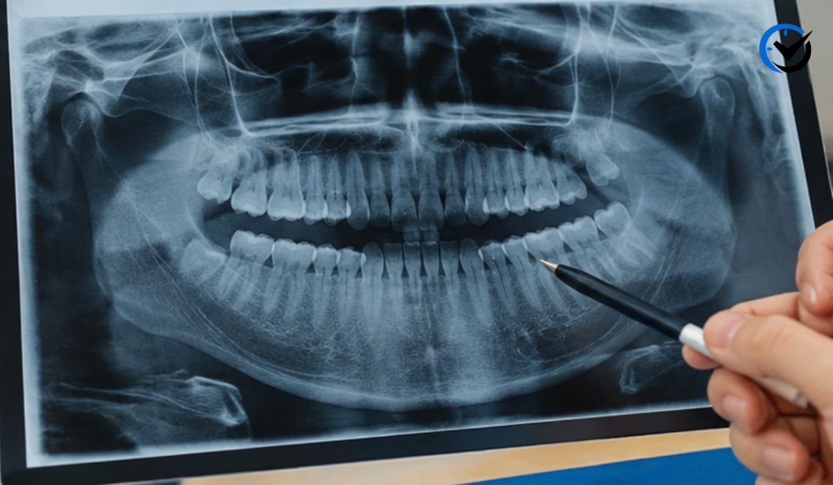Hard Bump on Gums by Molar